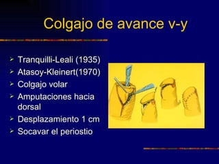 Colgajo de avance v-y

   Tranquilli-Leali (1935)
   Atasoy-Kleinert(1970)
   Colgajo volar
   Amputaciones hacia
    dorsal
   Desplazamiento 1 cm
   Socavar el periostio
 