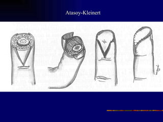 Atasoy-Kleinert
 