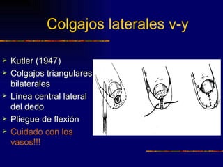 Colgajos laterales v-y

   Kutler (1947)
   Colgajos triangulares
    bilaterales
   Línea central lateral
    del dedo
   Pliegue de flexión
   Cuidado con los
    vasos!!!
 