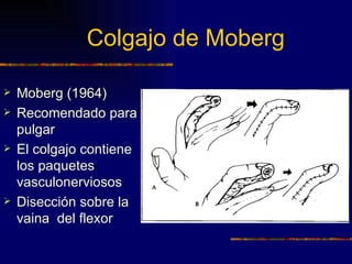 Colgajo de Moberg

   Moberg (1964)
   Recomendado para el
    pulgar
   El colgajo contiene
    los paquetes
    vasculonerviosos
   Disección sobre la
    vaina del flexor
 