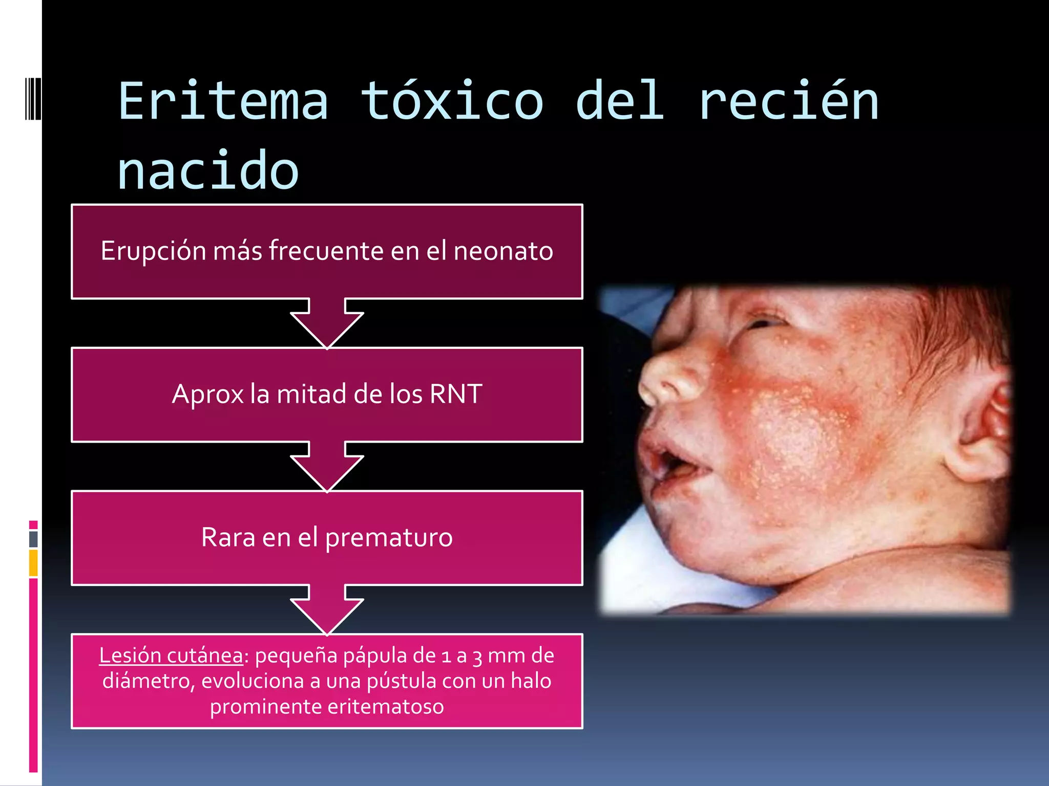 lesiones-dermatol-gicas-del-reci-n-nacido-sano-ppt