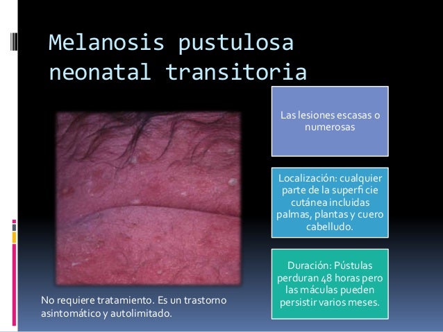 Lesiones dermatológicas del recién nacido sano