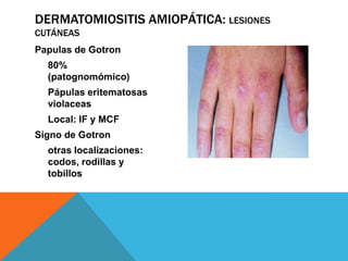Lesiones dermatol+ôgicas en enfermedades autoinmunes