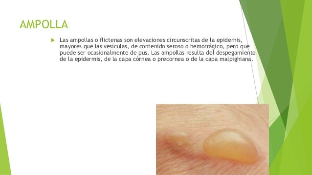 Si es posible curar el hongo de las uñas por el medio público