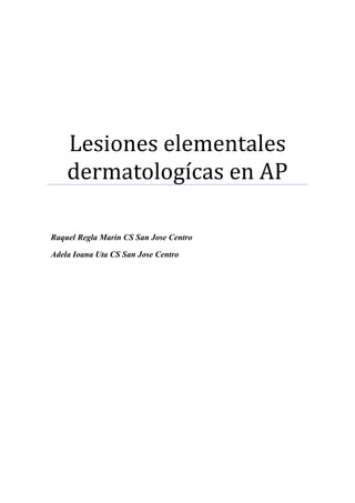 Lesiones elementales
    dermatologícas en AP

Raquel Regla Marin CS San Jose Centro

Adela Ioana Uta CS San Jose Centro
 