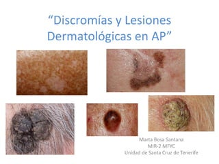 “Discromías y Lesiones
Dermatológicas en AP”
Marta Bosa Santana
MIR-2 MFYC
Unidad de Santa Cruz de Tenerife
 