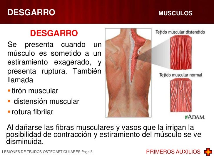 Duele la espátula da en la mano y el cuello como curar