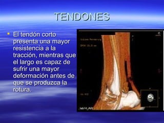 TTEENNDDOONNEESS 
 EEll tteennddóónn ccoorrttoo 
pprreesseennttaa uunnaa mmaayyoorr 
rreessiisstteenncciiaa aa llaa 
ttrraacccciióónn,, mmiieennttrraass qquuee 
eell llaarrggoo eess ccaappaazz ddee 
ssuuffrriirr uunnaa mmaayyoorr 
ddeeffoorrmmaacciióónn aanntteess ddee 
qquuee ssee pprroodduuzzccaa llaa 
rroottuurraa.. 
 