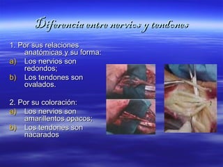 DDiiffeerreenncciiaa eennttrree nneerrvviiooss yy tteennddoonneess 
11.. PPoorr ssuuss rreellaacciioonneess 
aannaattóómmiiccaass yy ssuu ffoorrmmaa:: 
aa)) LLooss nneerrvviiooss ssoonn 
rreeddoonnddooss;; 
bb)) LLooss tteennddoonneess ssoonn 
oovvaallaaddooss.. 
22.. PPoorr ssuu ccoolloorraacciióónn:: 
aa)) LLooss nneerrvviiooss ssoonn 
aammaarriilllleennttooss ooppaaccooss;; 
bb)) LLooss tteennddoonneess ssoonn 
nnaaccaarraaddooss 
 