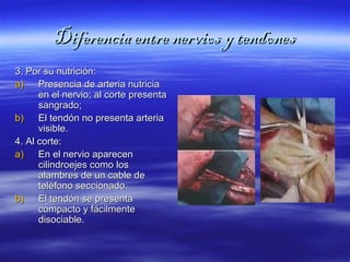 DDiiffeerreenncciiaa eennttrree nneerrvviiooss yy tteennddoonneess 
33.. PPoorr ssuu nnuuttrriicciióónn:: 
aa)) PPrreesseenncciiaa ddee aarrtteerriiaa nnuuttrriicciiaa 
eenn eell nneerrvviioo;; aall ccoorrttee pprreesseennttaa 
ssaannggrraaddoo;; 
bb)) EEll tteennddóónn nnoo pprreesseennttaa aarrtteerriiaa 
vviissiibbllee.. 
44.. AAll ccoorrttee:: 
aa)) EEnn eell nneerrvviioo aappaarreecceenn 
cciilliinnddrrooeejjeess ccoommoo llooss 
aallaammbbrreess ddee uunn ccaabbllee ddee 
tteellééffoonnoo sseecccciioonnaaddoo.. 
bb)) EEll tteennddóónn ssee pprreesseennttaa 
ccoommppaaccttoo yy ffáácciillmmeennttee 
ddiissoocciiaabbllee.. 
 