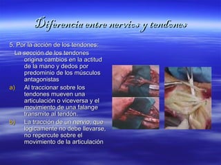 DDiiffeerreenncciiaa eennttrree nneerrvviiooss yy tteennddoonneess 
55.. PPoorr llaa aacccciióónn ddee llooss tteennddoonneess:: 
LLaa sseecccciióónn ddee llooss tteennddoonneess 
oorriiggiinnaa ccaammbbiiooss eenn llaa aaccttiittuudd 
ddee llaa mmaannoo yy ddeeddooss ppoorr 
pprreeddoommiinniioo ddee llooss mmúússccuullooss 
aannttaaggoonniissttaass 
aa)) AAll ttrraacccciioonnaarr ssoobbrree llooss 
tteennddoonneess mmuueevveenn uunnaa 
aarrttiiccuullaacciióónn oo vviicceevveerrssaa yy eell 
mmoovviimmiieennttoo ddee uunnaa ffaallaannggee 
ttrraannssmmiittee aall tteennddóónn.. 
bb)) LLaa ttrraacccciióónn ddee uunn nneerrvviioo,, qquuee 
llóóggiiccaammeennttee nnoo ddeebbee lllleevvaarrssee,, 
nnoo rreeppeerrccuuttee ssoobbrree eell 
mmoovviimmiieennttoo ddee llaa aarrttiiccuullaacciióónn 
 