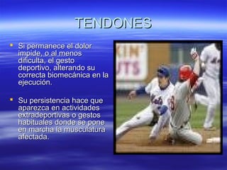 TTEENNDDOONNEESS 
 SSii ppeerrmmaanneeccee eell ddoolloorr 
iimmppiiddee,, oo aall mmeennooss 
ddiiffiiccuullttaa,, eell ggeessttoo 
ddeeppoorrttiivvoo,, aalltteerraannddoo ssuu 
ccoorrrreeccttaa bbiioommeeccáánniiccaa eenn llaa 
eejjeeccuucciióónn.. 
 SSuu ppeerrssiisstteenncciiaa hhaaccee qquuee 
aappaarreezzccaa eenn aaccttiivviiddaaddeess 
eexxttrraaddeeppoorrttiivvaass oo ggeessttooss 
hhaabbiittuuaalleess ddoonnddee ssee ppoonnee 
eenn mmaarrcchhaa llaa mmuussccuullaattuurraa 
aaffeeccttaaddaa.. 
 