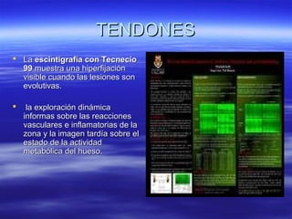 TTEENNDDOONNEESS 
 LLaa eesscciinnttiiggrraaffííaa ccoonn TTeeccnneecciioo 
9999 mmuueessttrraa uunnaa hhiippeerrffiijjaacciióónn 
vviissiibbllee ccuuaannddoo llaass lleessiioonneess ssoonn 
eevvoolluuttiivvaass.. 
 llaa eexxpplloorraacciióónn ddiinnáámmiiccaa 
iinnffoorrmmaass ssoobbrree llaass rreeaacccciioonneess 
vvaassccuullaarreess ee iinnffllaammaattoorriiaass ddee llaa 
zzoonnaa yy llaa iimmaaggeenn ttaarrddííaa ssoobbrree eell 
eessttaaddoo ddee llaa aaccttiivviiddaadd 
mmeettaabbóólliiccaa ddeell hhuueessoo.. 
 