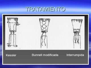 TTRRAATTAAMMIIEENNTTOO 
 