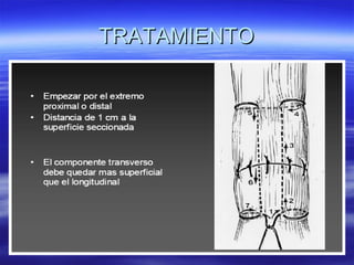 TTRRAATTAAMMIIEENNTTOO 
 