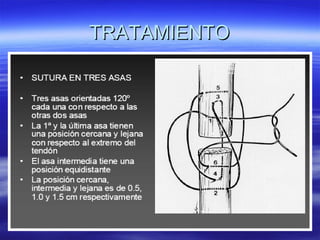 TTRRAATTAAMMIIEENNTTOO 
 