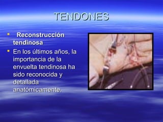 TTEENNDDOONNEESS 
 RReeccoonnssttrruucccciióónn 
tteennddiinnoossaa 
 EEnn llooss úúllttiimmooss aaññooss,, llaa 
iimmppoorrttaanncciiaa ddee llaa 
eennvvuueellttaa tteennddiinnoossaa hhaa 
ssiiddoo rreeccoonnoocciiddaa yy 
ddeettaallllaaddaa 
aannaattóómmiiccaammeennttee.. 
 