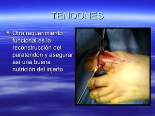 TTEENNDDOONNEESS 
 OOttrroo rreeqquueerriimmiieennttoo 
ffuunncciioonnaall eess llaa 
rreeccoonnssttrruucccciióónn ddeell 
ppaarraatteennddóónn yy aasseegguurraarr 
aassíí uunnaa bbuueennaa 
nnuuttrriicciióónn ddeell iinnjjeerrttoo 
 