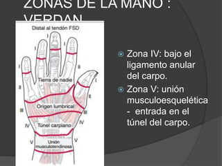 ZONA IV
 Origen de los músculos
lumbricales y túnel
carpiano.
 Nueve tendones y el
nervio mediano
 Intrasinoviales
 