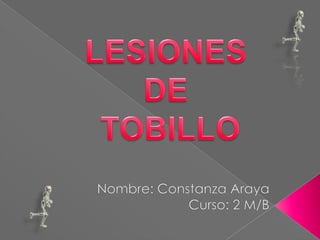 LESIONES  DE  TOBILLO Nombre: Constanza Araya Curso: 2 M/B 