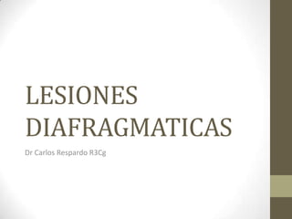 LESIONES
DIAFRAGMATICAS
Dr Carlos Respardo R3Cg
 