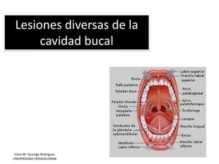 Lesiones diversas de la
cavidad bucal
Clara M. Quiroga Rodríguez
UNIVERSIDAD VERACRUZANA
 