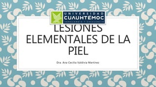 LESIONES
ELEMENTALES DE LA
PIEL
Dra. Ana Cecilia Valdivia Martínez
 