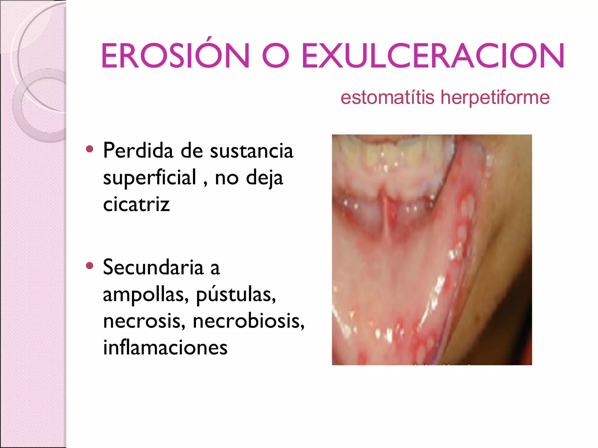 Lesiones Elementales patologia bucal | PPT