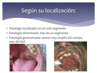 Patología localizada: en un solo segmento
 Patología diseminada: mas de un segmento
 Patología generalizada: sector muy amplio del cuerpo,
mas del 80%
Según su localización:
 