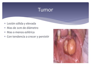  Lesión sólida y elevada
 Mas de 2cm de diámetro
 Mas o menos esférica
 Con tendencia a crecer y persistir
Tumor
 