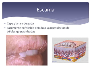  Capa plana y delgada
 Fácilmente exfoliable debido a la acumulación de
células queratinizadas
Escama
 