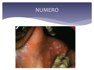 NUMERO
 