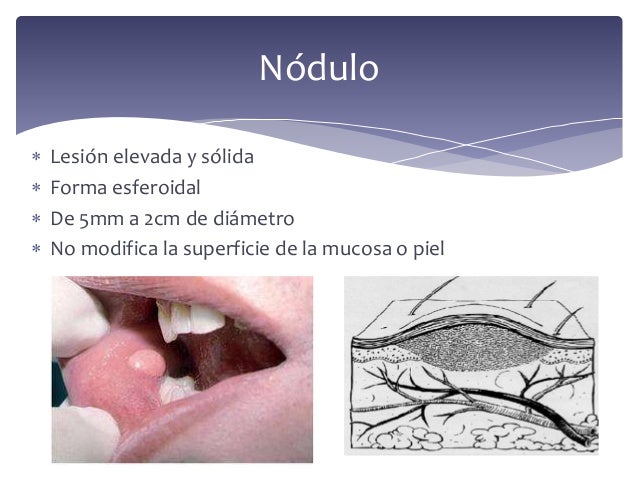 Lesiones elementales
