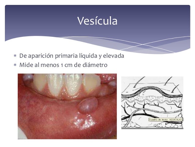 Lesiones elementales