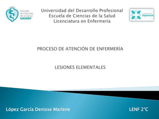 PROCESO DE ATENCIÓN DE ENFERMERÍA
LESIONES ELEMENTALES
López García Denisse Marlene LENF 2°C
 