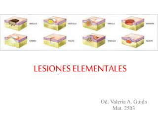 LESIONES ELEMENTALES
Od. Valeria A. Guida
Mat. 2503
 