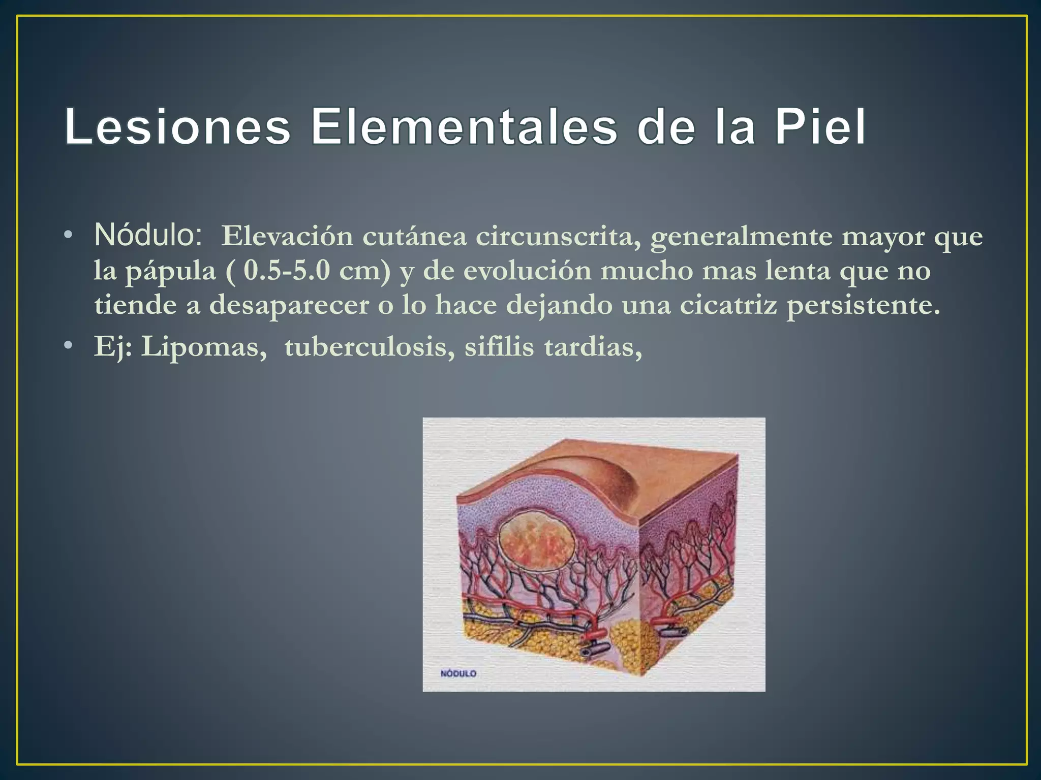 lesiones-elementales-de-la-piel-pptx