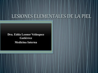 Dra. Edda Leonor Velásquez
Gutiérrez
Medicina Interna
 