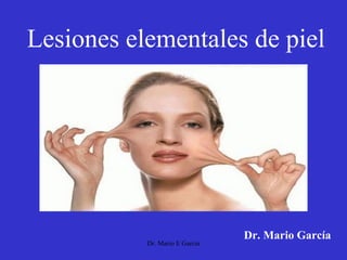 Lesiones elementales de piel
Dr. Mario García
Dr. Mario E Garcia
 