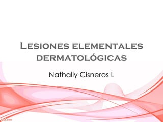 Lesiones elementales
  dermatológicas
    Nathally Cisneros L
 