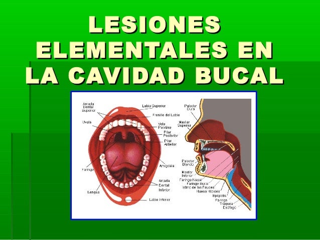 Lesiones Elementales En La Cavidad Bucal