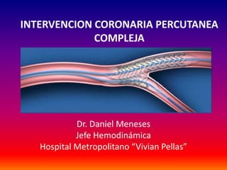 INTERVENCION CORONARIA PERCUTANEA 
COMPLEJA 
Dr. Daniel Meneses 
Jefe Hemodinámica 
Hospital Metropolitano “Vivian Pellas” 
 