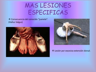 Consiste en mantener las caderas y extremidades inferiores en rotación externa. EN DEHORSFigura A. El rotulo alineado con el 2° metatarso.Figura B. El rotulo no esta alineado con el 2° metatarso.