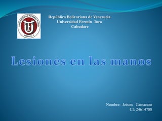 República Bolivariana de Venezuela
Universidad Fermín Toro
Cabudare
Nombre: Jeison Camacaro
CI: 24614788
 