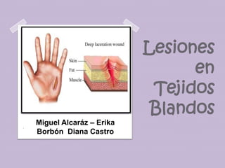 Lesiones
                                   en
                              Tejidos
                              Blandos
.
    Miguel Alcaráz – Erika
    Borbón Diana Castro
 