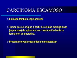 CARCINOMA ESCAMOSO
 Llamado también    espinocelular

 Tumor quese origina a partir de células malpighianas
 (espinosas) de epidermis con maduración hacia la
 formación de queratina.

 Presenta elevada   capacidad de metastatizar.
 