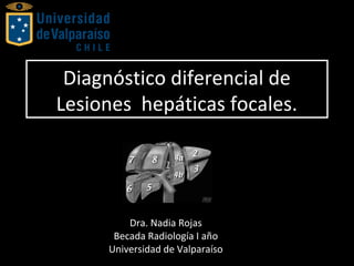Diagnóstico diferencial de
Lesiones hepáticas focales.
Diagnóstico diferencial de
Lesiones hepáticas focales.
Dra. Nadia Rojas
Becada Radiología I año
Universidad de Valparaíso
 