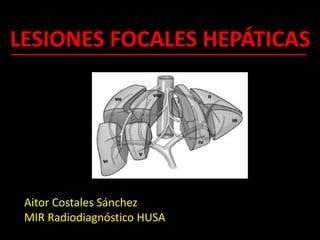 LESIONES FOCALES HEPÁTICAS
Aitor Costales Sánchez
MIR Radiodiagnóstico HUSA
 