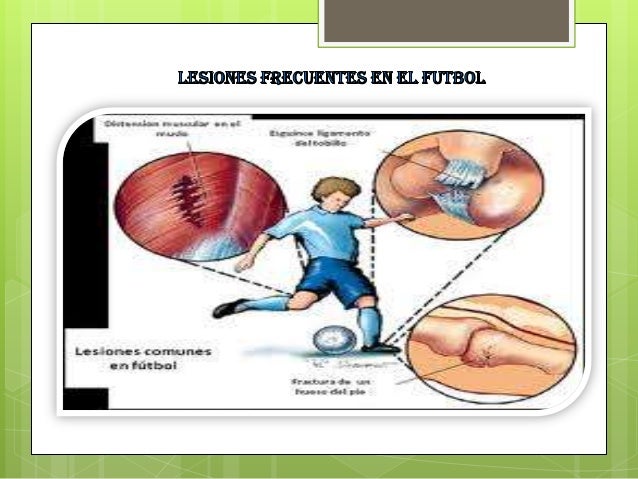 Lesiones Y Tratamientos En El Futbol