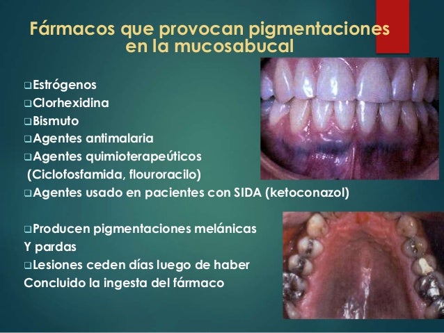 Lesiones Físicas de la Cavidad Bucal Lesiones Físicas de la Cavidad Bucal